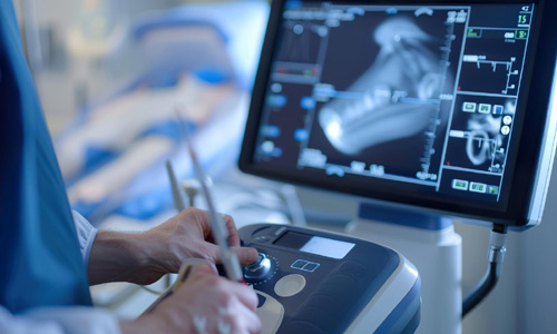 Heart Echo in Nagpur